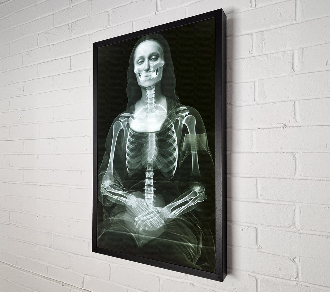  A Canvas Print of Xray Woman Canvas Wall Art
