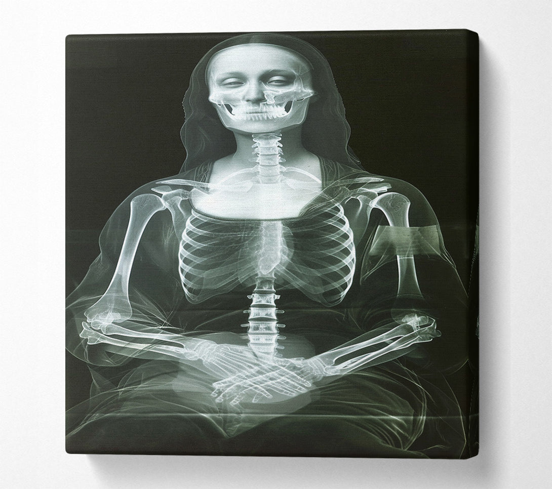  A Canvas Print of Xray Woman Canvas Wall Art