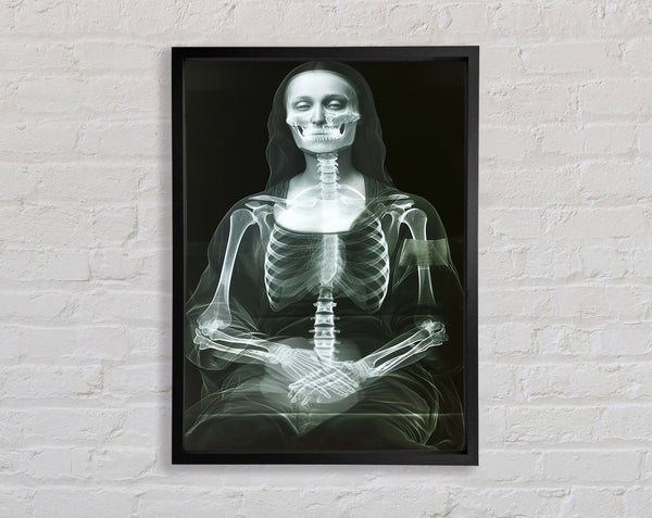 Xray Woman Framed Print